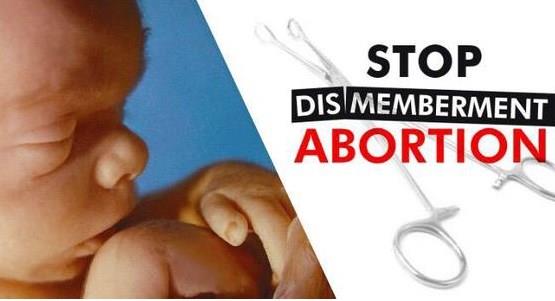 Texas Gov. Signs Bill Banning Dismemberment Abortions