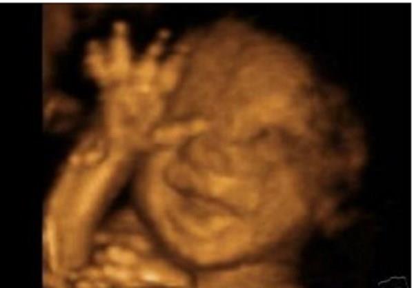House Passes Pro-Life Bill Banning Late-Term Abortions