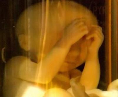 Congressional Committee: Ban Abortions After Baby’s Heartbeat