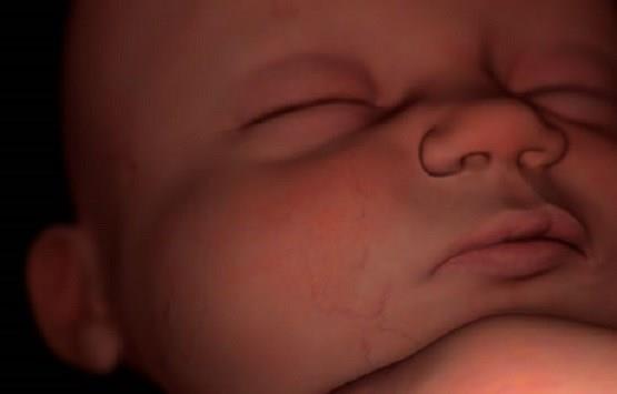 Texas Clinic: Dismembering Unborn-Baby While Heart Beating