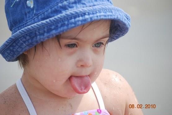 Denmark Eliminates Down Syndrome Except 4 Babies