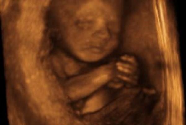 Oklahoma Bill To Make Killing Unborn-Babies Crime